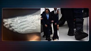 'Vuruldu' iddiasına tepki! CHP lideri Özel ayağının nasıl kırıldığını açıkladı, filmleri ortaya çıktı: Parmaklarında kırıklar var