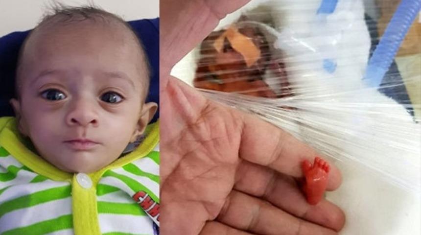 Mucize bebek! Doğuştan savaş&ccedil;ı