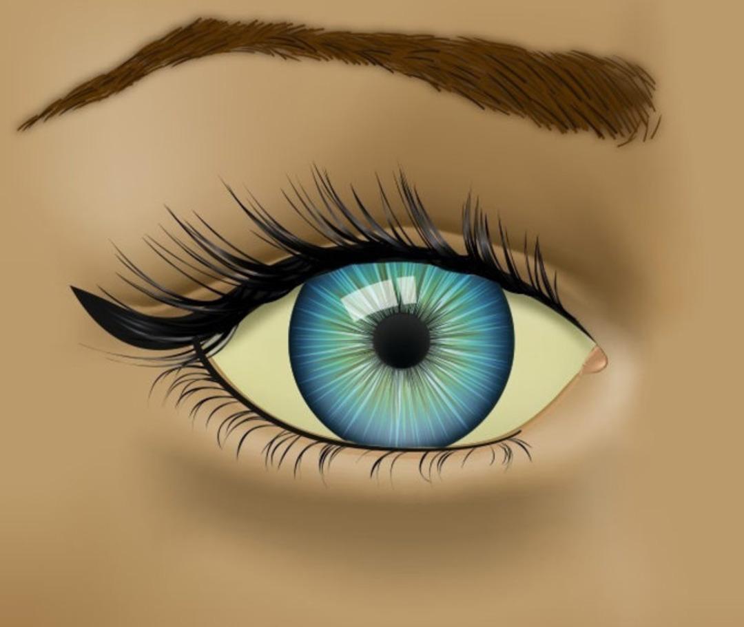 G&ouml;z&uuml;n&uuml;zdeki kızarlıklığı sakın hafife almayın