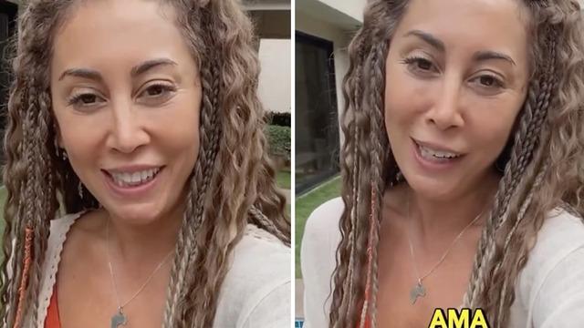 Kenya'da yaşayan Türk maymun çiçeğini böyle anlattı! 'Acil durum yok' sözlerine yorum yağdı: Sen bir süre bu taraflara gelme