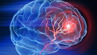 'Kritik öneme sahip' Sağlıklı beyin için 10 süper gıda! Alzheimer riskini azaltıyor, beyni zırh gibi güçlendiriyor