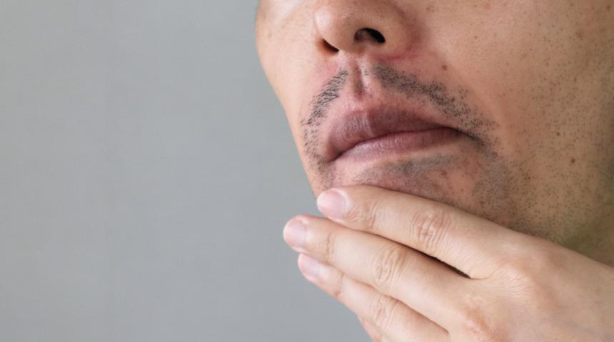 Mewing nedir, nasıl yapılır? Mewing işe yarıyor mu, sağlıklı mı?