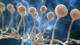 Kara mantar hastalığı nedir, nasıl geçer? Kara mantar hastalığı Türkiye'de var mı? Kara mantar hastalığı belirtileri ve tedavisi