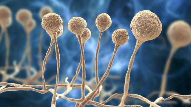 Kara mantar hastalığı nedir, nasıl geçer? Kara mantar hastalığı Türkiye'de var mı? Kara mantar hastalığı belirtileri ve tedavisi