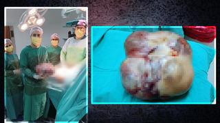Ameliyattan korkup kaçtı ama... Vücudundan tam 15 kiloluk dev kitle çıktı!