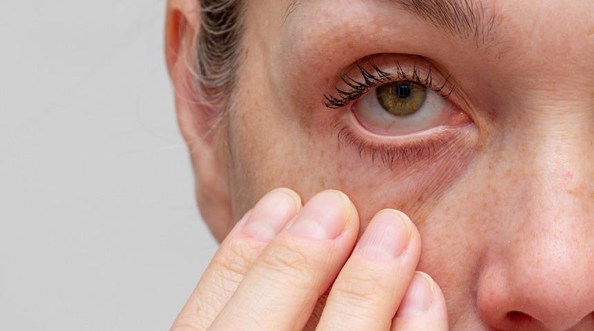 Üveit nedir, tehlikeli midir? Üveit belirtileri ve tedavisi