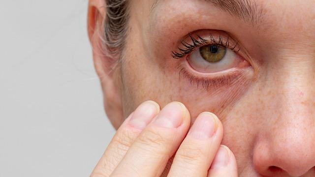 Üveit nedir, tehlikeli midir? Üveit belirtileri ve tedavisi