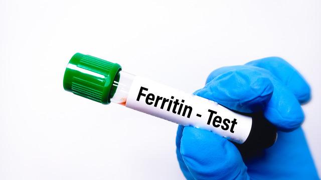 Ferritin düşüklüğü nedir, belirtileri nelerdir? Ferritin düşüklüğü tedavisi