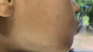 Diş ağrısı çeken küçük yeğenini şifacıya götürdü! Yüzünde solucanlar çıkmaya başladı... Yanağında delik oluştu