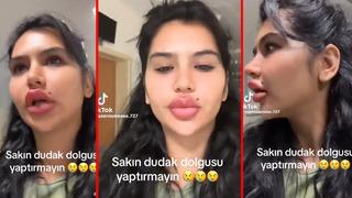 Hastaneden 'hataya düşmeyin' diyerek seslendi! Dudaklarımdaki dolgular erimiyor ve birikmiş
