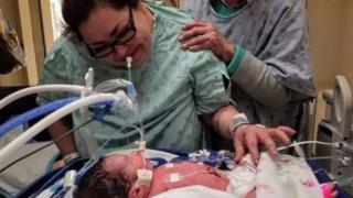 Her satırı korkunç! Hamile kadına kasap bıçağıyla saldırarak öldürdü... Keserek karnındaki bebeğini çaldı