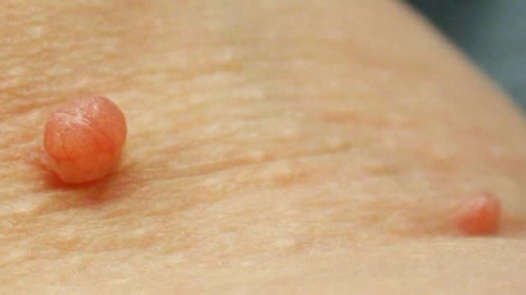 Cildimizin 5 &ouml;nemli sinyali