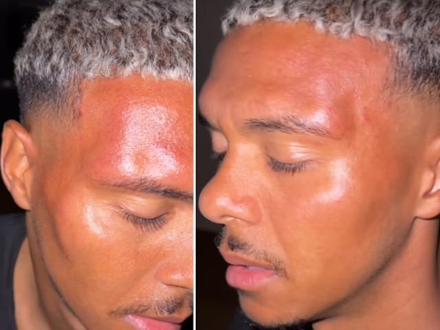 Nürnberg oyuncusu saldırıya uğradı!