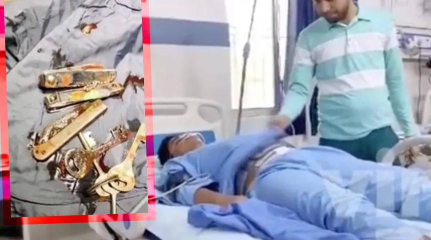Doktorlar adamın midesinden anahtar, tırnak makası ve çakı çıkarttı! Akıllara tek soru geldi: Bunların hepsini nasıl yutmuş?