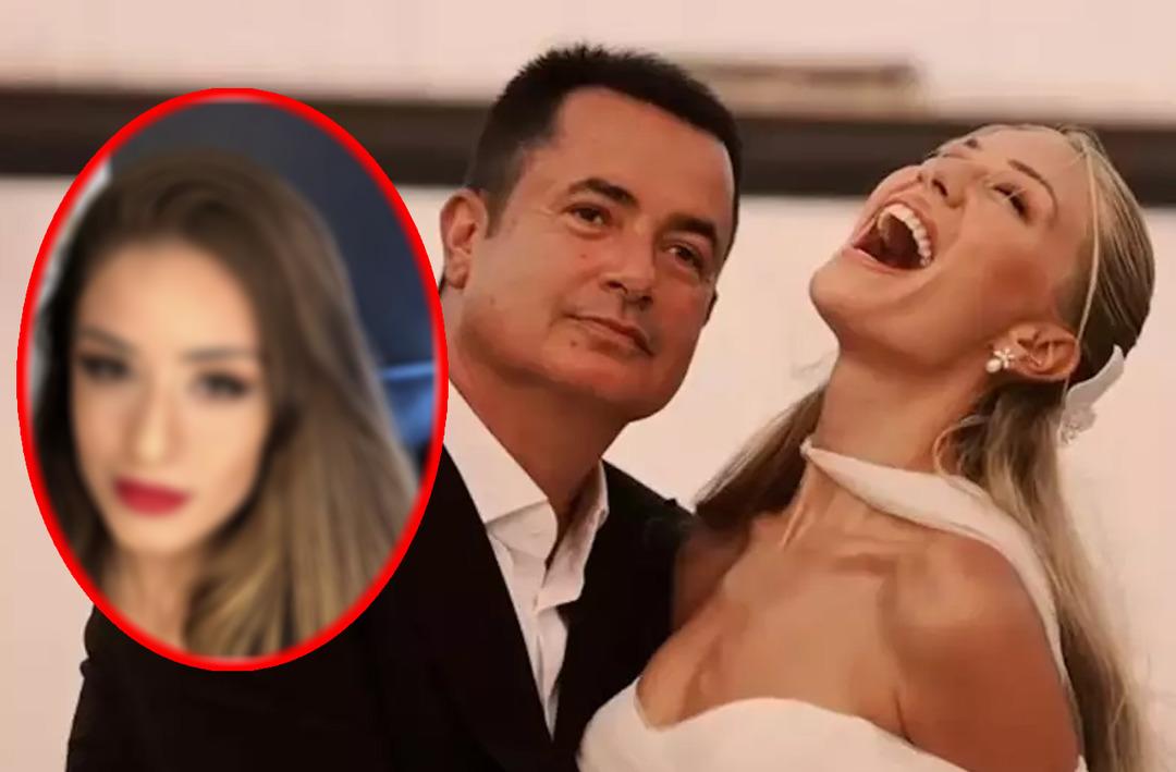 Acun Ilıcalı'nın eşi Ay&ccedil;a &Ccedil;ağla Ilıcalı d&uuml;ğ&uuml;n sonrası değişimiyle g&uuml;ndemde! Ay&ccedil;a &Ccedil;ağla Altunkaya'nın estetiksiz hali...