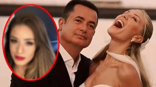 Acun Ilıcalı'nın eşi Ayça Çağla Ilıcalı düğün sonrası değişimiyle gündemde! Ayça Çağla Altunkaya'nın estetiksiz hali...