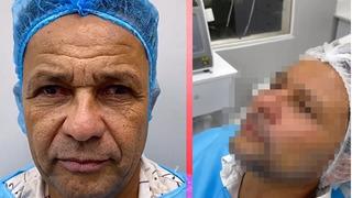 Tüm yüzüne estetik yaptırdı! Bambaşka biri oldu... Bir gören bir daha baktı: Tanıyabilene aşk olsun