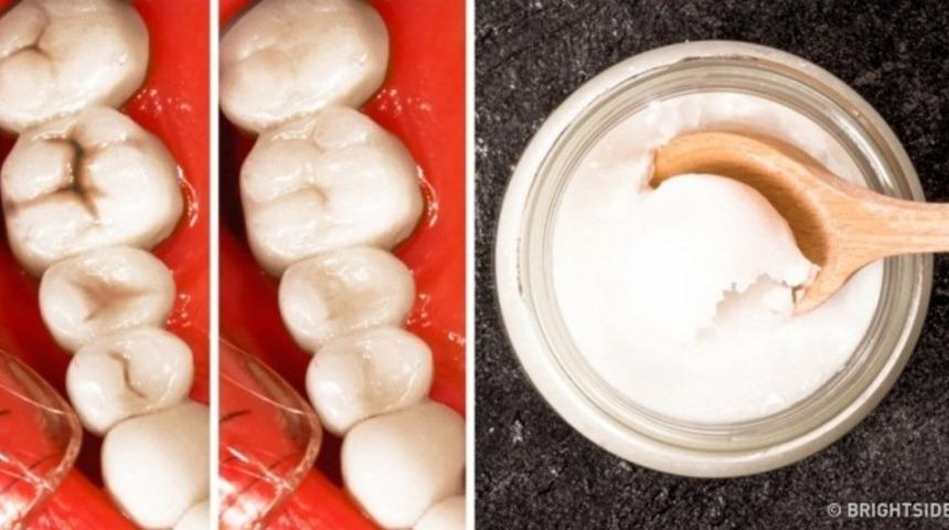 Dişlerinizi güvenle göstermenize yardımcı olacak 9 yiyecek