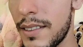 Deniz bir anda kana bulandı! Çığlık çığlığa yardım istedi... Köpek balığı adamın bacağından bir parça et koparttı: Dehşet karaya çıkınca anlaşıldı