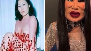 Bir gören bir daha baktı! Estetik operasyonların sonrasında bambaşka birine dönüştü... Kendine ne yapmışsın?