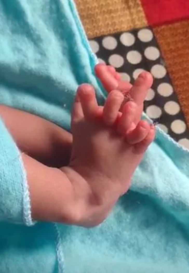 Kendisi küçücük ama etkisi çok büyük! 14 el ve 12 ayak parmağıyla doğan bebek ilan edildi... "Çok mutluyuz" G3
