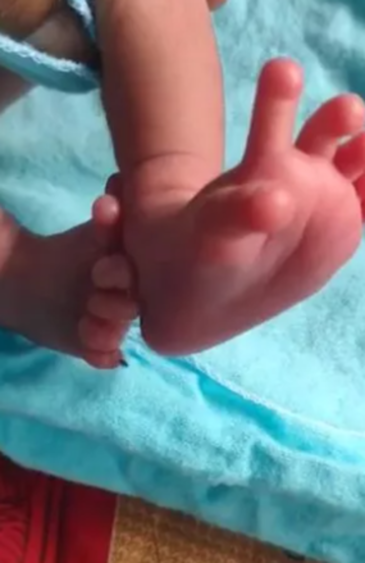 Kendisi küçücük ama etkisi çok büyük! 14 el ve 12 ayak parmağıyla doğan bebek ilan edildi... "Çok mutluyuz" G4