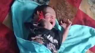 Kendisi küçücük ama etkisi çok büyük! 14 el ve 12 ayak parmağıyla doğan bebek ilan edildi... Çok mutluyuz