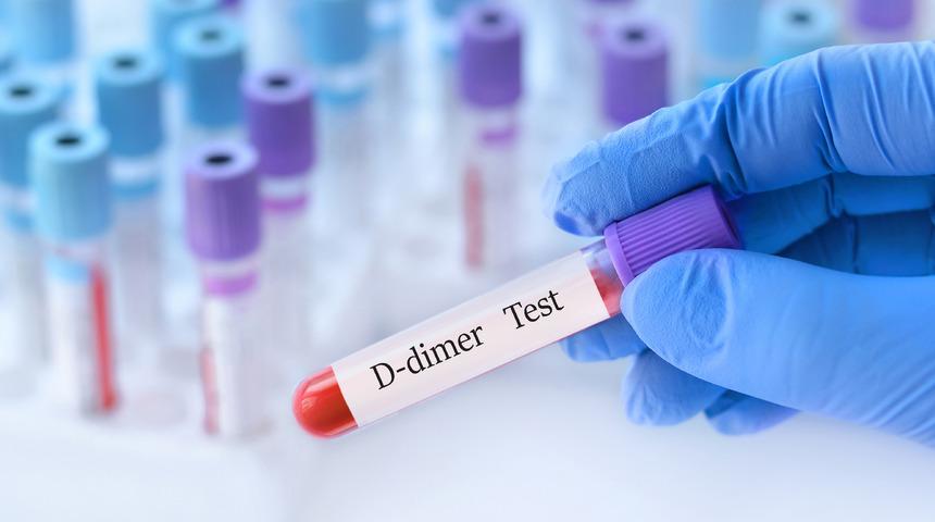 D dimer nedir, en yüksek kaç olmalı? D Dimer yüksekliği ne anlama gelir?