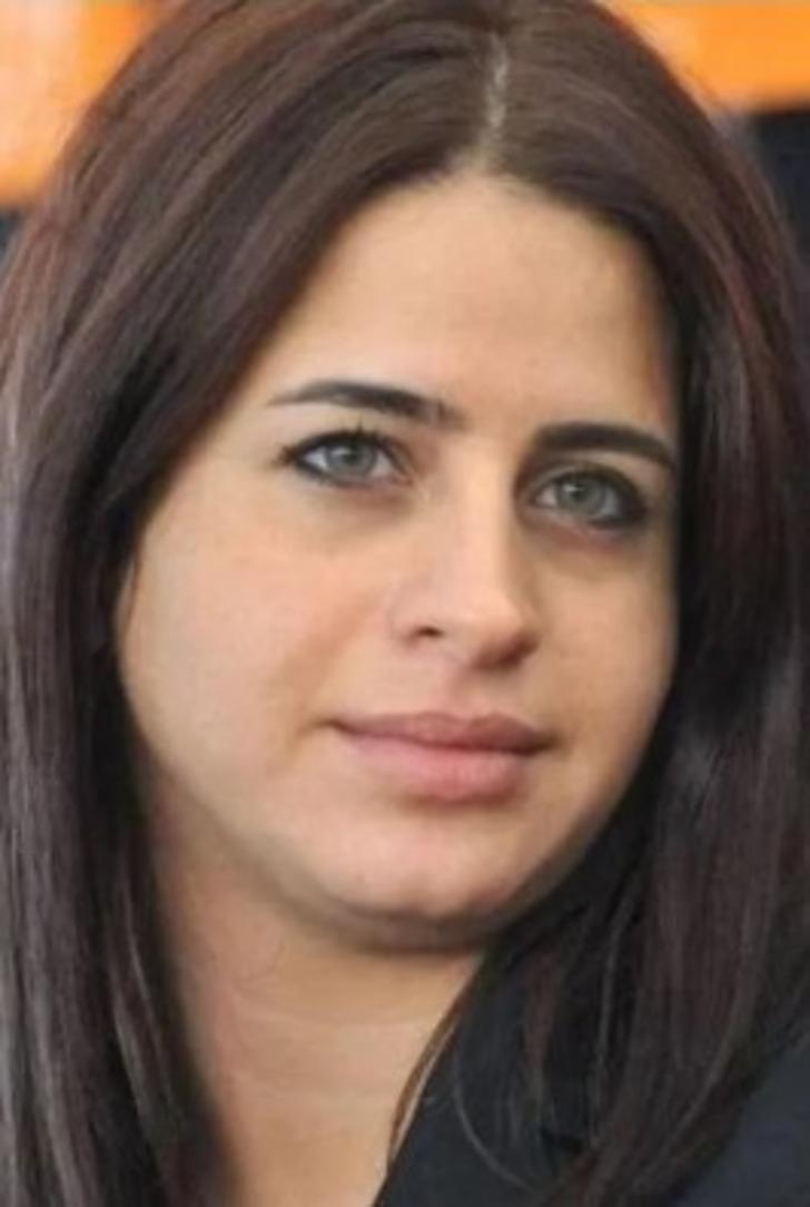 Bahar Süreyya'sı Büşra Pekin değişimiyle yine gündem oldu! Sosyal medyada eski hali hatırlatıldı! 'Doktoruna ödül verilmeli'  G1