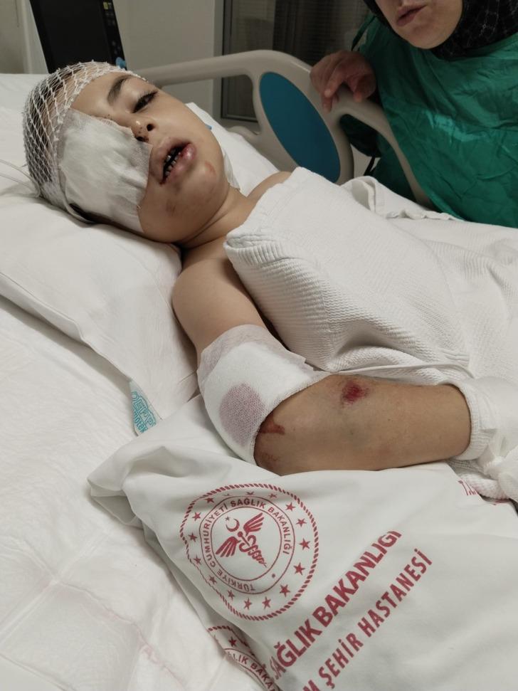 6 yaşındaki Emre servis aracının altında ezildi, şoför kucaklayıp site kapısına götürdü! Küçük çocuk yoğun bakımda hayat mücadelesi verirken servis şoförü serbest bırakıldı G5