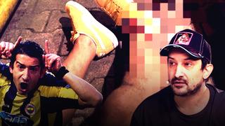 Fenerbahçe'den Serhat Akın'a yapılan silahlı saldırı sonrası bir tepki daha geldi! Hukuki işlemleri başlattı.