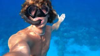 20 yaşındaki dalgıç kabusu yaşadı! Denizin ortasında bir anda köpek balığı saldırdı... Kendisini kurtarmayı başardı: Kolundan diş parçaları çıkartıldı