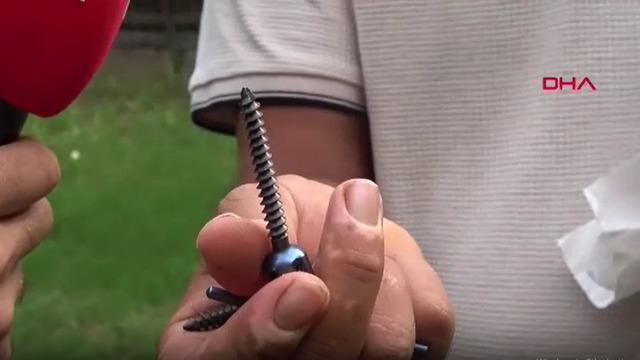 Bel ağrısıyla gitti, ameliyat sonrası yürüyemez hale geldi! Duyunca inanamadı: Haberi olmadan 8 platin takılmış!