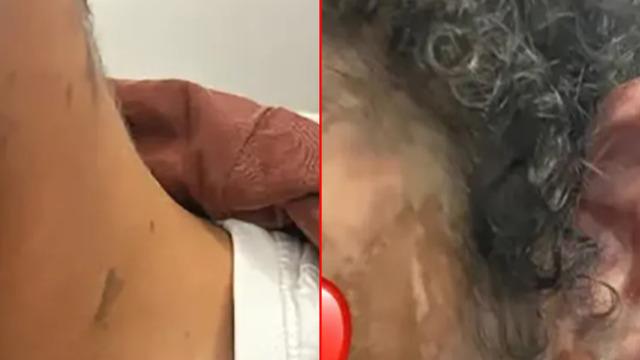 Okulda korkunç asit saldırısı: 2 öğrenci ve 1 öğretmen yaralandı... Elektrikli scooter ile gelip dehşet saçtı