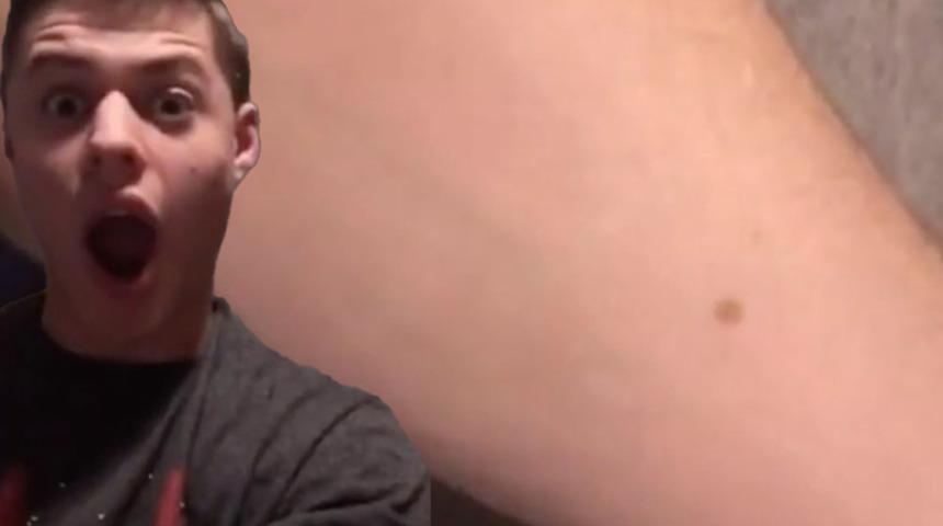 Bütün erkeklerin aynı yerde 'ben'i var! Tuhaf keşfini sosyal medyadan paylaştı... Herkes kendisini kontrol etti