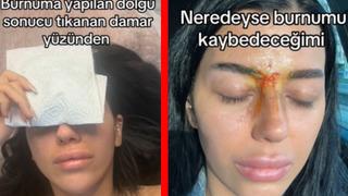 Basit bir dolgu yaptırmak istemişti! Hayatının en korkunç anlarını yaşadı: Geçici körlük, bilinç kaybı...