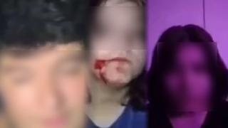 Sosyal medyada infial uyandıran video! Küçük kız hepsini tek tek ifşa etti: 'Bu korkuyla yaşamaya çalışıyorum'