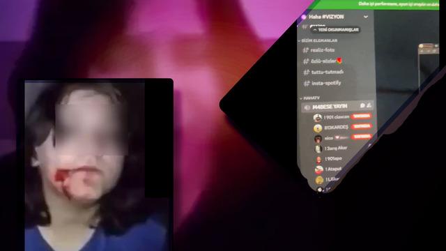 Bu ne rezalet! Şantaj yüzünden kendini kesen kız sonrası utanmadan itiraf etti: Paramızı böyle kazanıyoruz! Bir daha yaparım, kimse bizi durduramaz