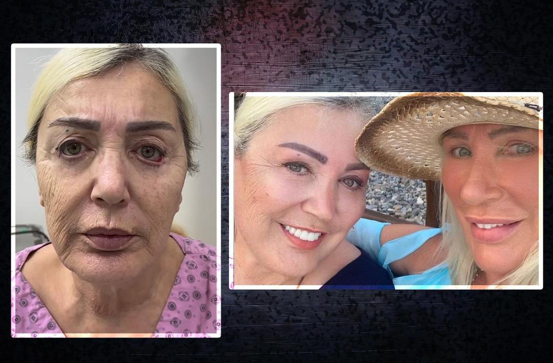 Gen&ccedil;leştirme operasyonu ge&ccedil;irmişti! Seda Sayan'ın ablası Nursel Sayan Yıldız'ı g&ouml;renler tanıyamadı 