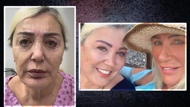 Gençleştirme operasyonu geçirmişti! Seda Sayan'ın ablası Nursel Sayan Yıldız'ı görenler tanıyamadı 