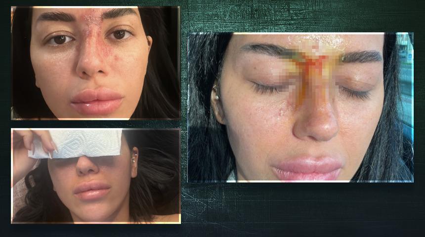 G&uuml;zelleşmek isterken hayatı karardı! Basit işlem k&ouml;rl&uuml;ğe neden oldu! Saatlerce bilinci kapandı