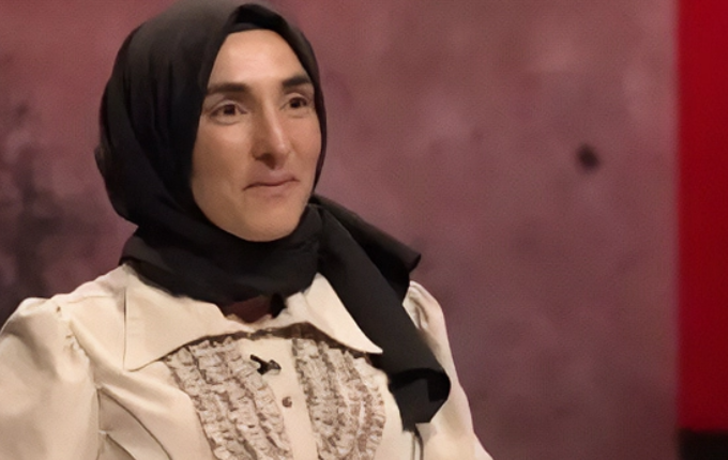 MasterChef Ayşe elendi ama gündemden düşmüyor! Yüzündeki değişim dikkat çekti G1