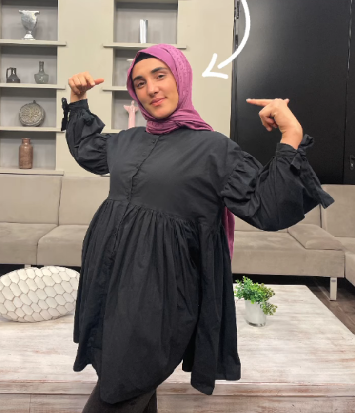 MasterChef Ayşe elendi ama gündemden düşmüyor! Yüzündeki değişim dikkat çekti G5