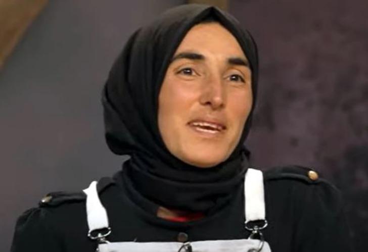MasterChef Ayşe elendi ama gündemden düşmüyor! Yüzündeki değişim dikkat çekti G2