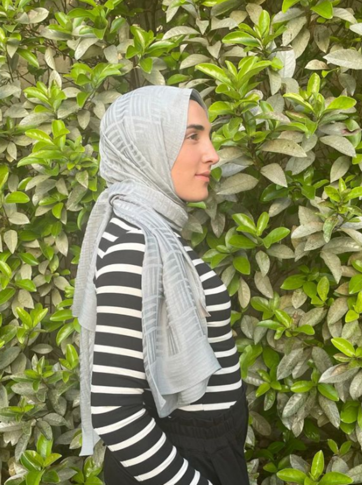 MasterChef Ayşe elendi ama gündemden düşmüyor! Yüzündeki değişim dikkat çekti G3