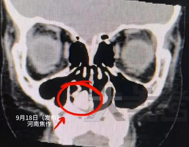 SİYAH BİR KİTLE FARK EDİLDİ