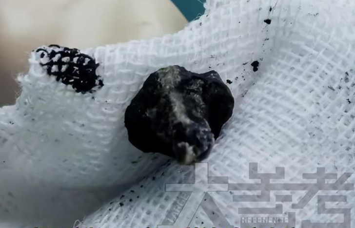 AMELİYATA KARAR VERDİLER