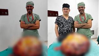 Yer: Trabzon... Doktorlar gözlerine inanamadı! Ağrı ve yürüme güçlüğü için hastaneye gitti: Karnından bu çıkartıldı!