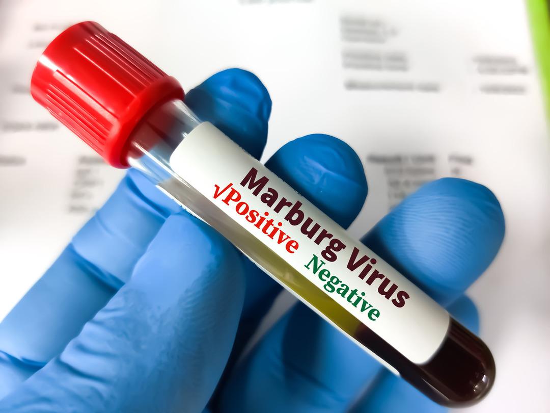 Doença horrível: literalmente apodrecendo por dentro! Vírus semelhante ao ebola mata 8 pessoas
