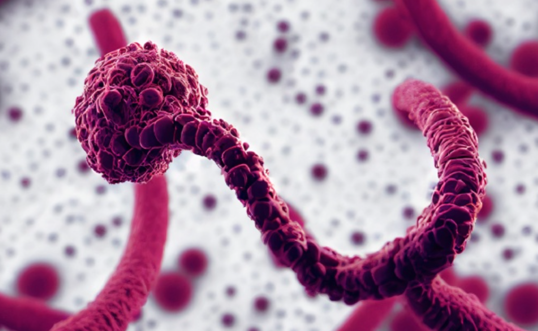 Kanamaya neden olan 'Marburg vir&uuml;s&uuml;' paniği! Bir haftada vaka sayısı zirve yaptı... 13 kişi hayatını kaybetti